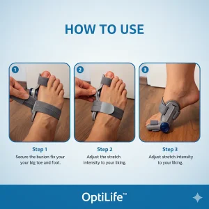 optilife™ bunion fix