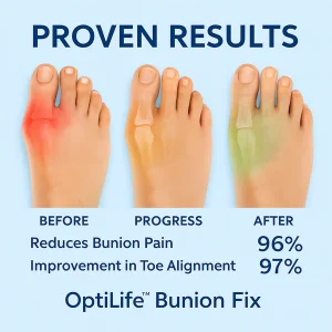 optilife™ bunion fix