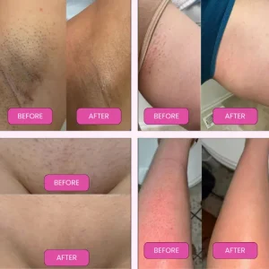 🪒2 in 1 electric shaver razors for women✨