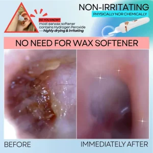 hot sale earwax vacuum safe painless ear cleaning for the whole family